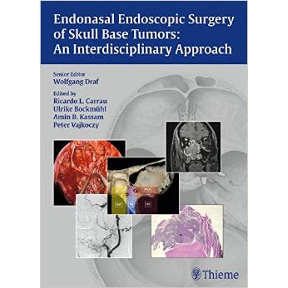 Endonasal Endoscopic Surgery Of Skull Base Tumors