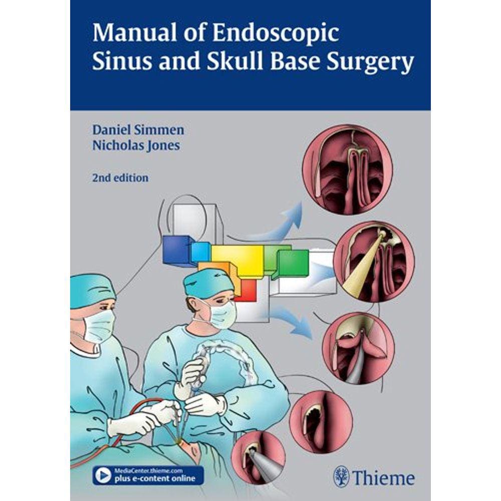 Manual Of Endoscopic Sinus And Skull Base Surgery