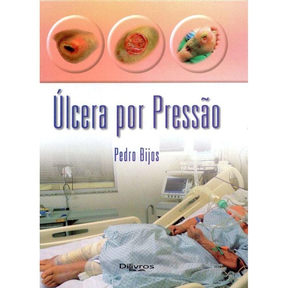 Ulcera Por Pressão