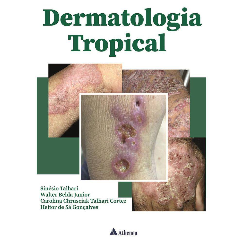 Dermatologia Tropical
