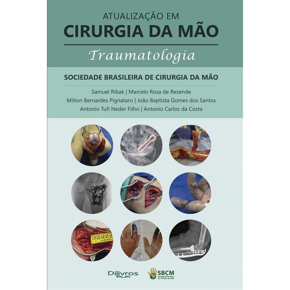 Atualizacao Em Cirurgia Da Mao Traumatologia