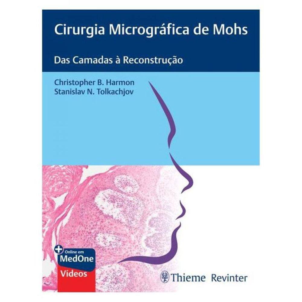 Cirurgia Micrográfica De Mohs