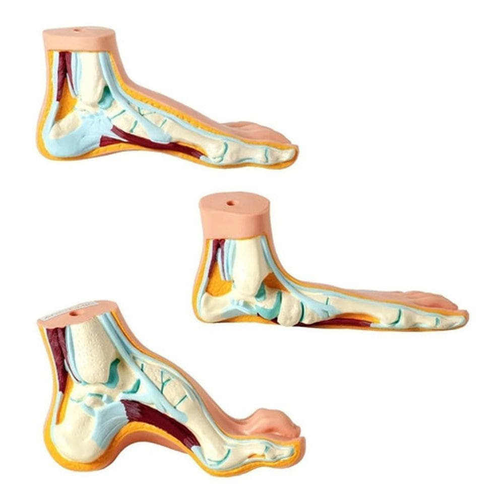 Pé 3 Modelo Anatomico Normal Chato Curvo Calcanhar Ortopedic