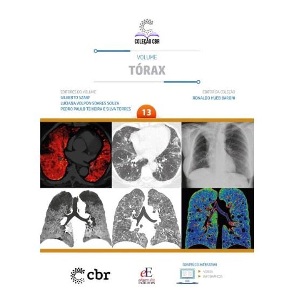 Coleção CBR Volume 13: Tórax