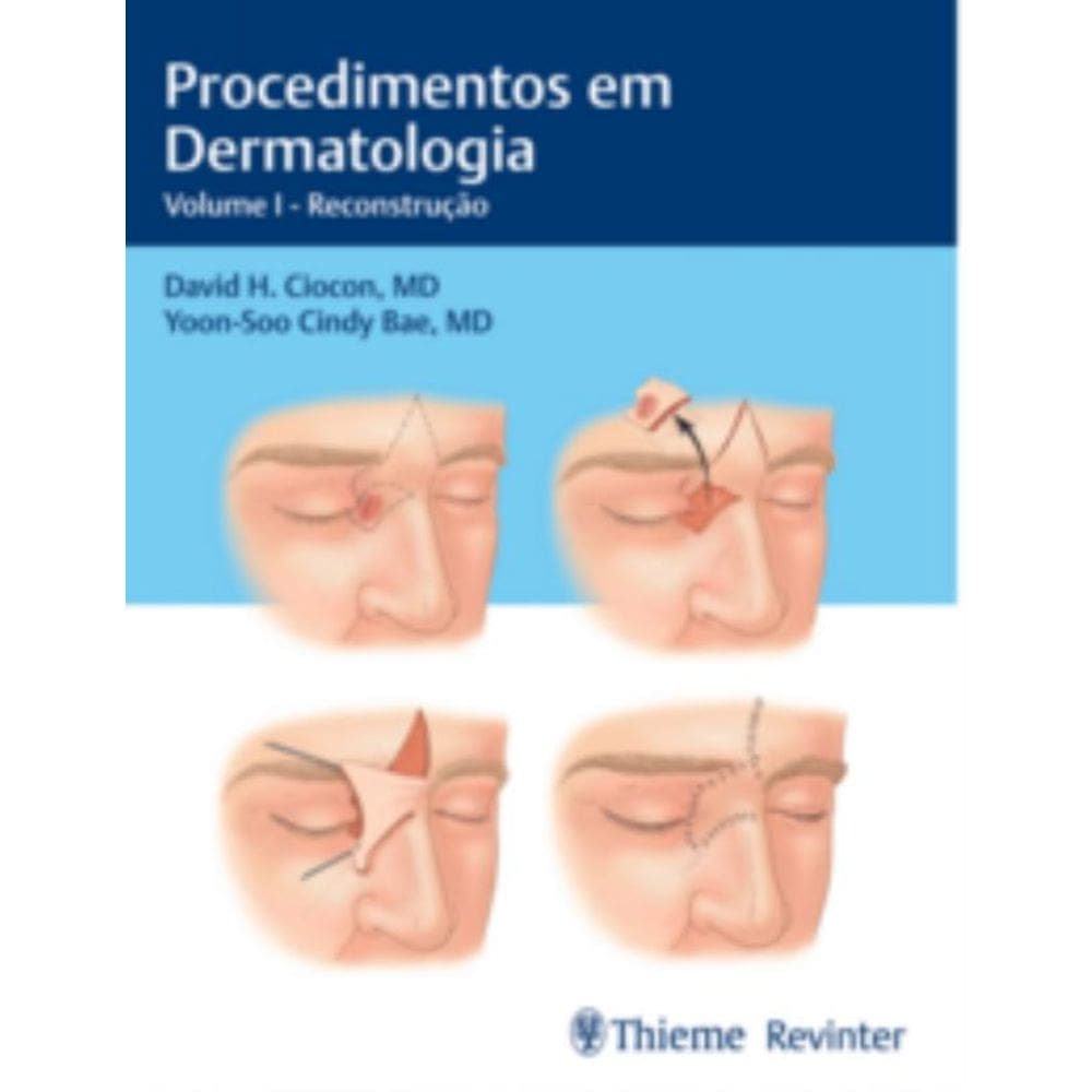 Procedimentos Em Dermatologia - Volume I - Reconst