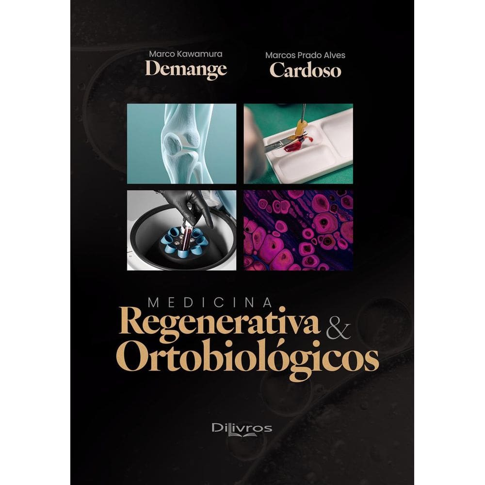 Medicina Regenerativa E Ortobiologicos