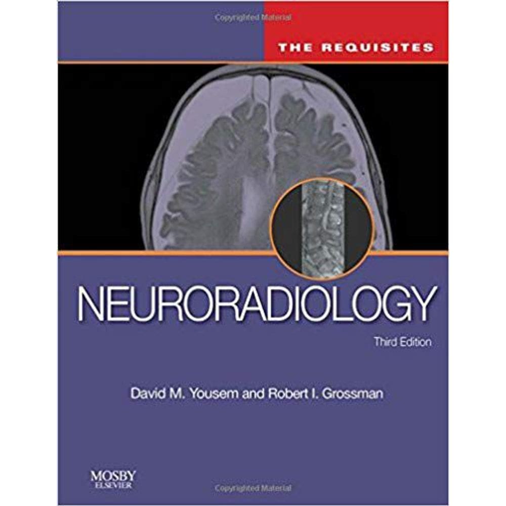 Neuroradiology: The Requisites