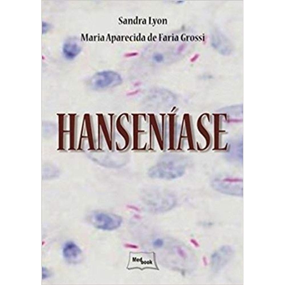 Hanseníase