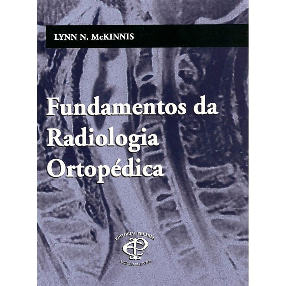 Livro Fundamentos Da Radiologia Ortopédica