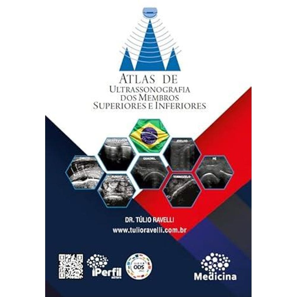 Atlas De Ultrassonografia Dos Membros E Inferiores