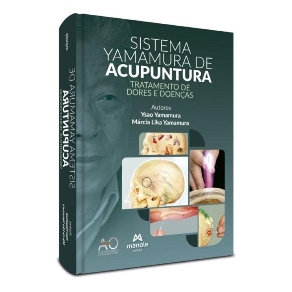 Sistema Yamamura De Acupuntura