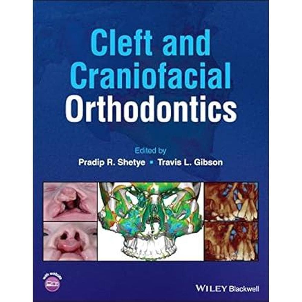 Cleft And Craniofacial Orthodontics