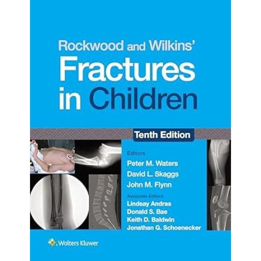 Rockwood And Wilkins Fractures In Children