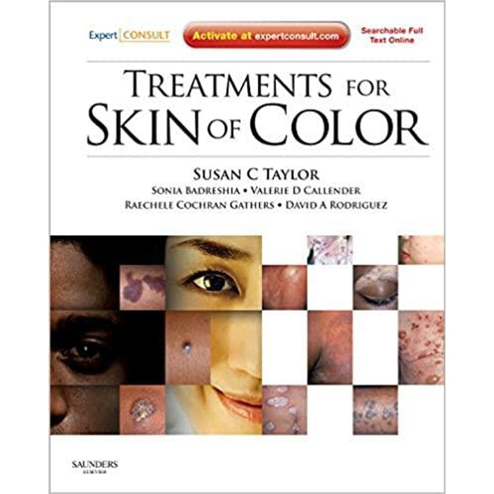 Treatments For Skin Of Color