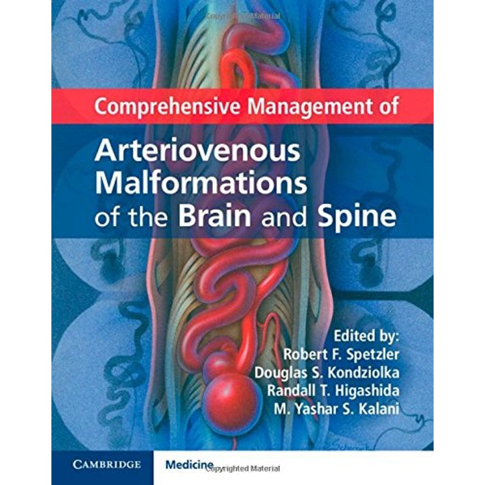 Comprehensive Manag Arteriovenous Malform Of Brain And Spine
