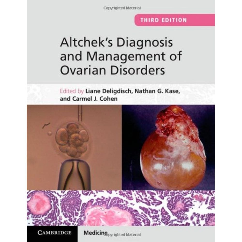 Altcheks Diagnosis And Management Of Ovarian Disorders