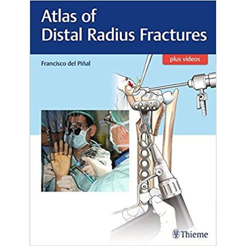 Atlas Of Distal Radius Fractures