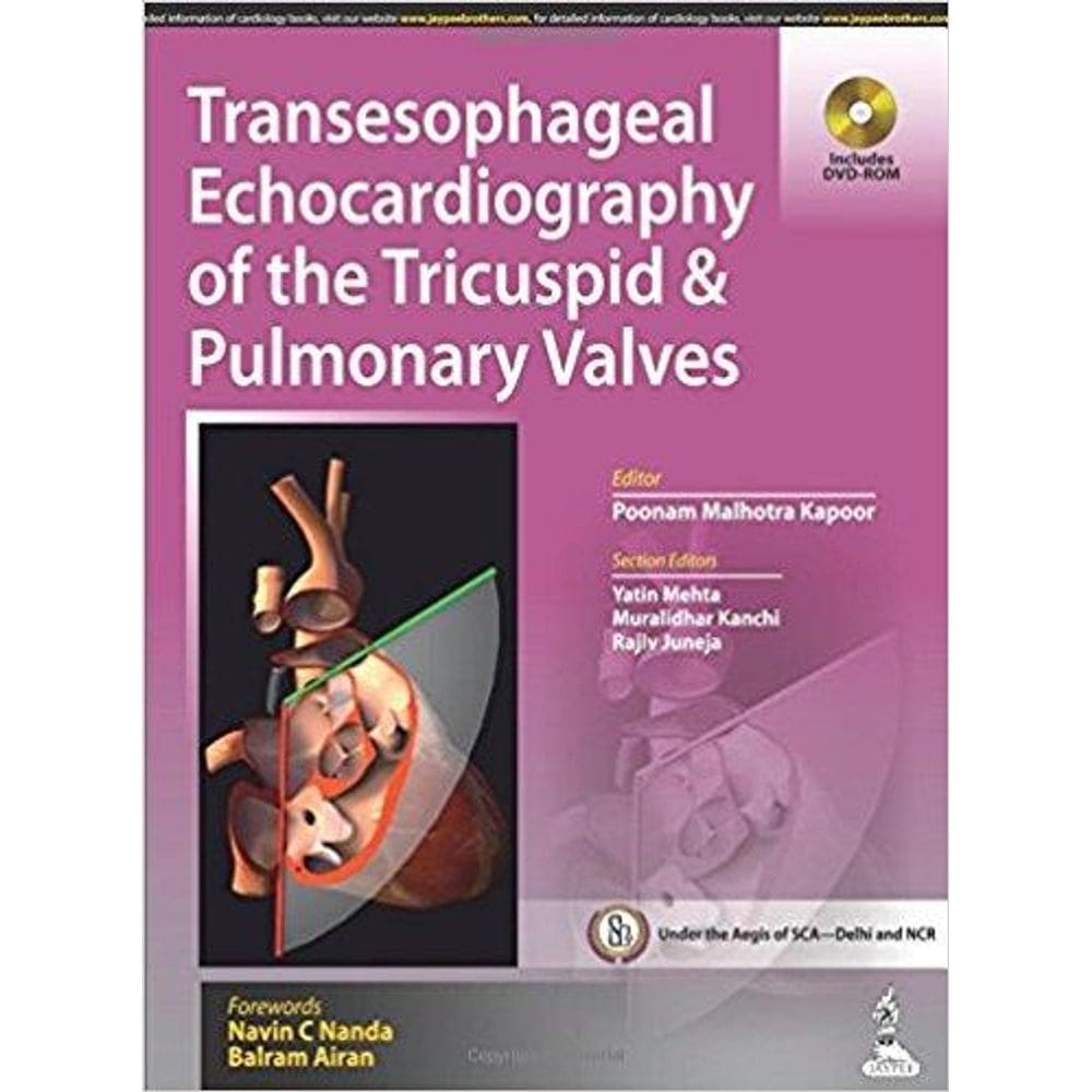 Transesophageal Echocardiography Of The Tricuspid And Pulmonary Valves
