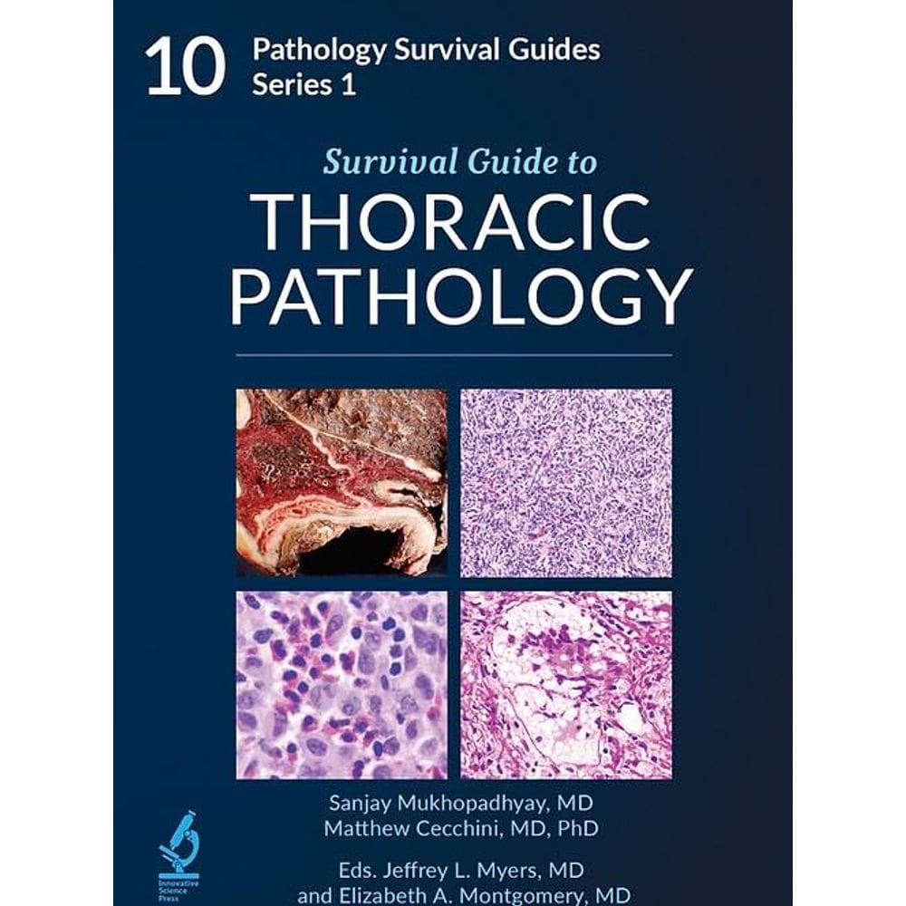 Survival Guide To Thoracic Pathology