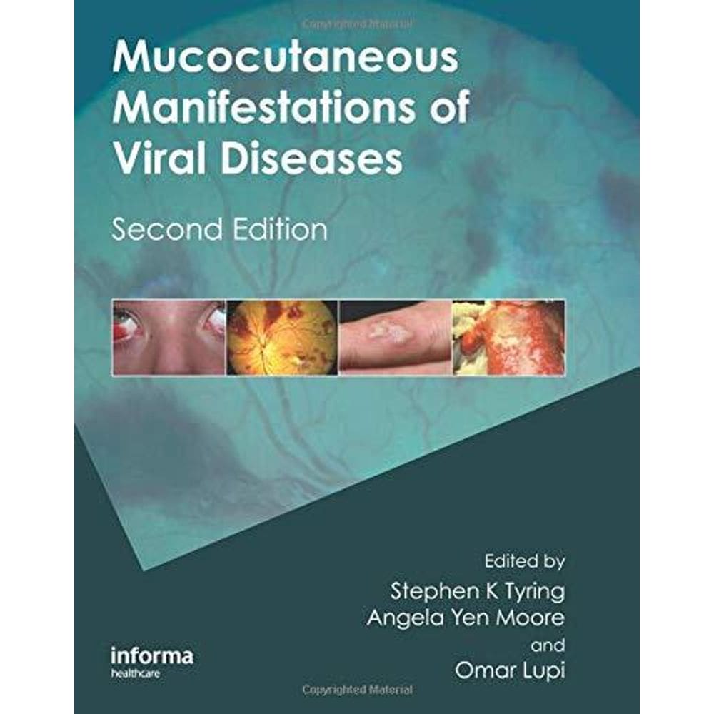 Mucocutaneous Manifestations Of Viral Diseases