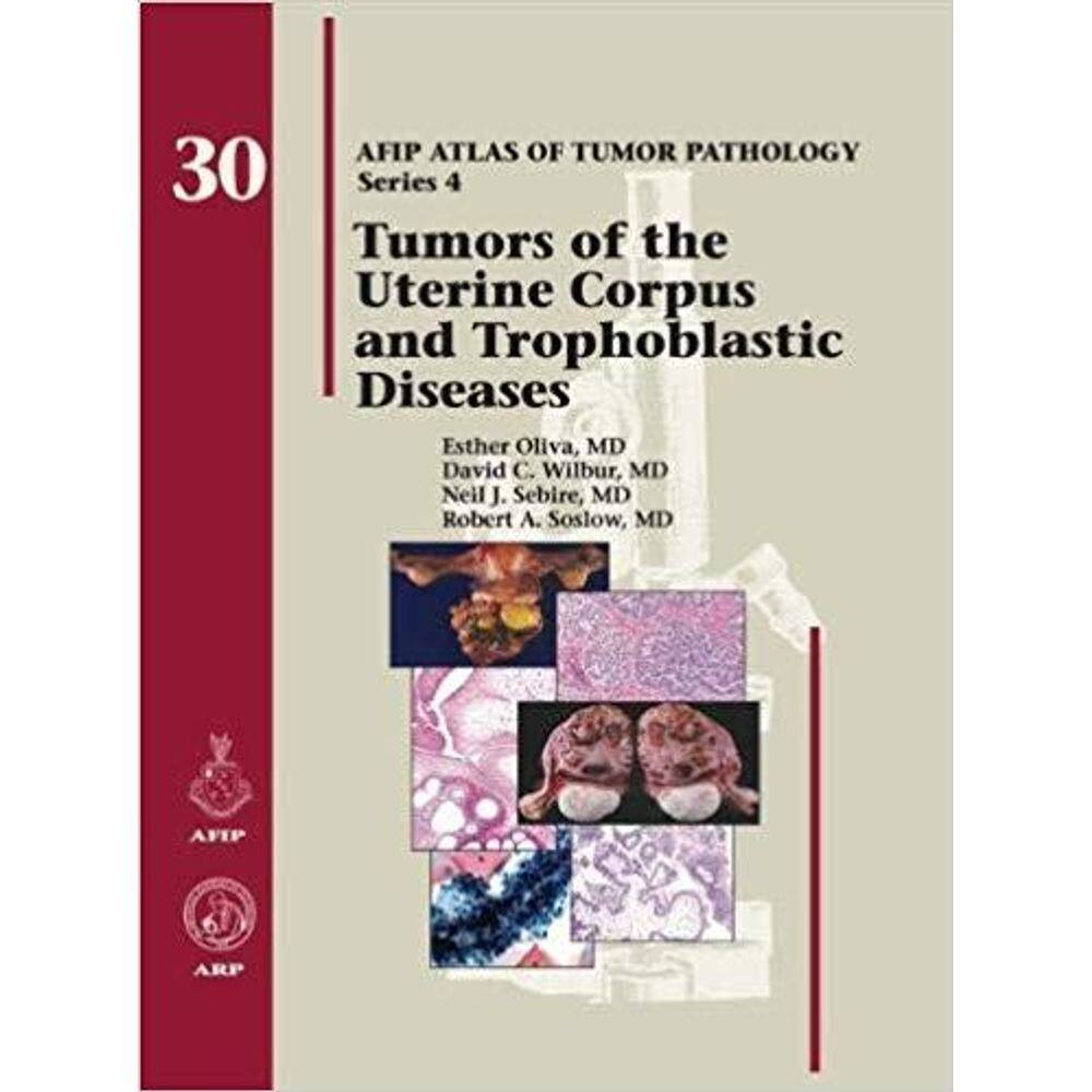 Tumors Of The Uterine Corpus And Gestational Trophoblastic Diseases