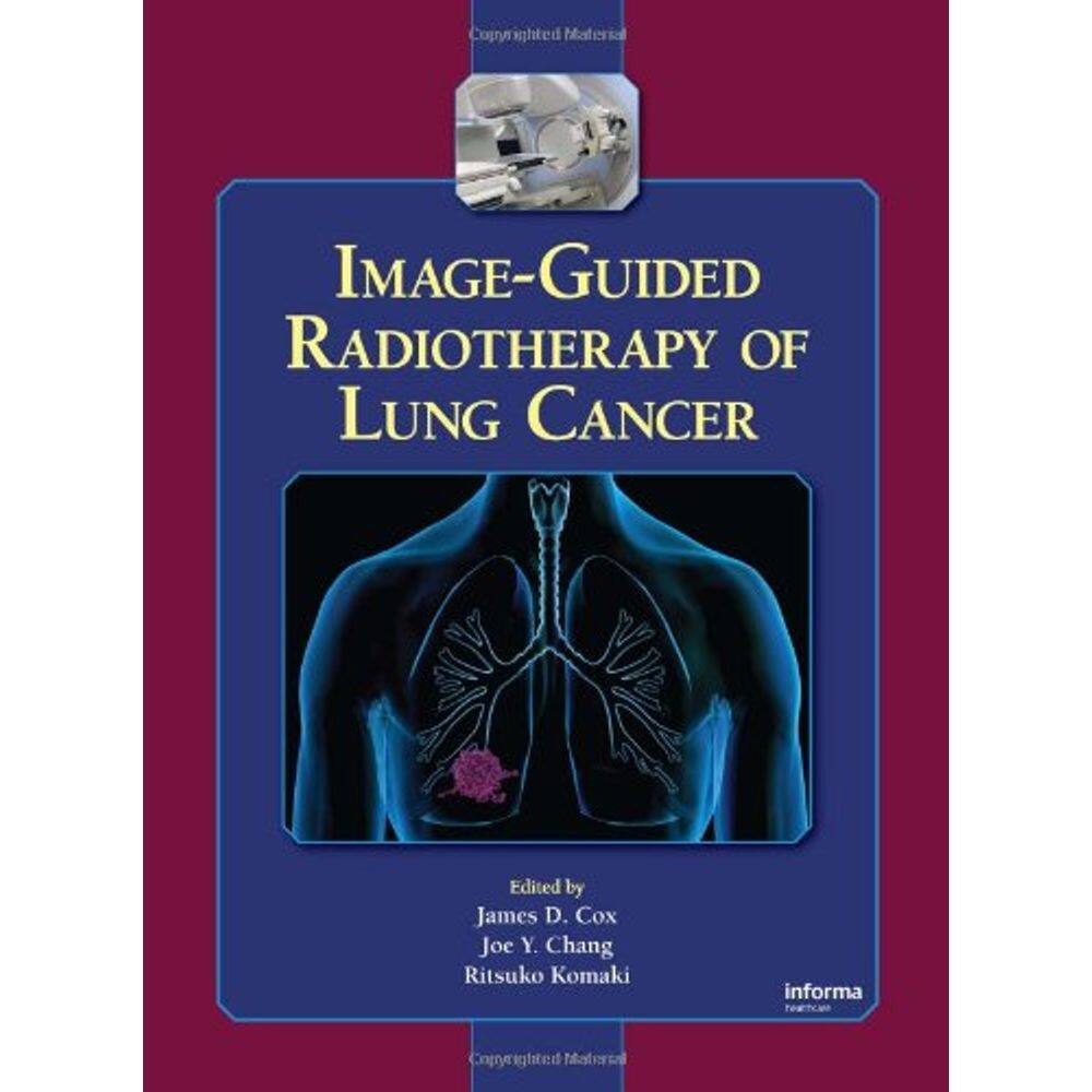 Image-Guided Radiotherapy Of Lung Cancer