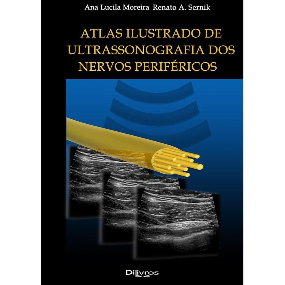 Atlas Ilustrado Ultrassonografia Dos Nervos PerifÉricos
