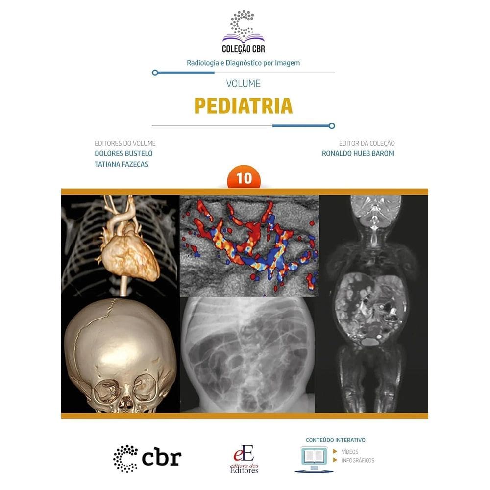 Coleção Cbr Volume 10 Pediatria Capa Dura 1 Outubro 2024