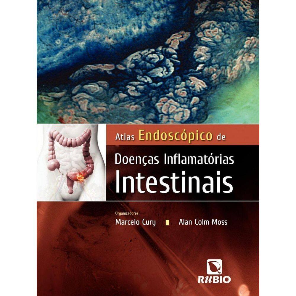 Livro: Atlas Endoscópico De Doenças Intestinais