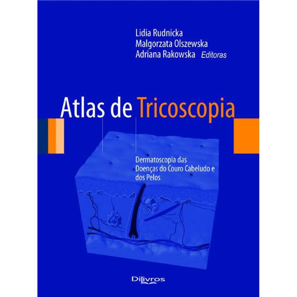 Livro Atlas De Tricoscopia - Dermatoscopia Doenças