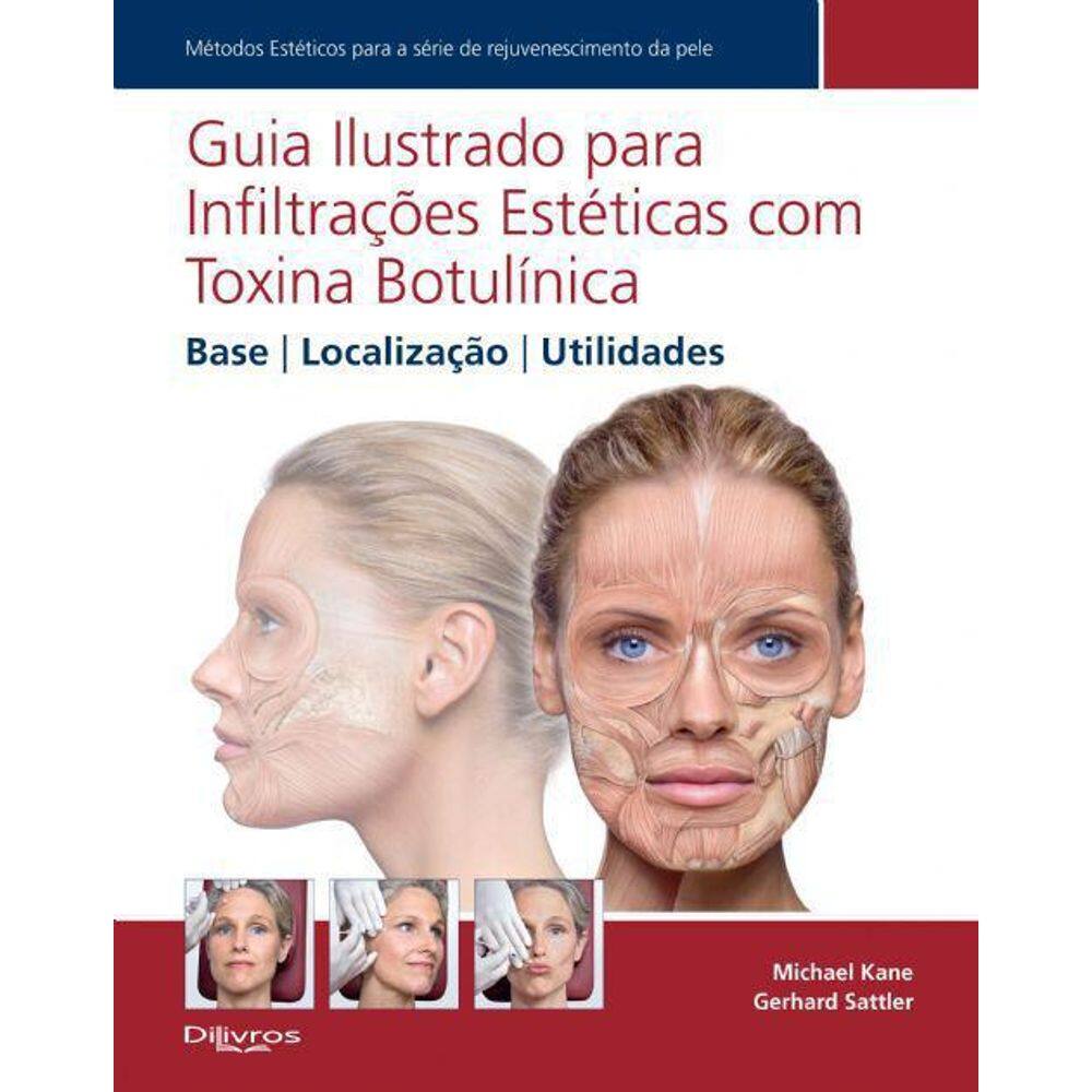 Livro Guia Ilustrado Para Infiltracoes Esteticas Com Toxina