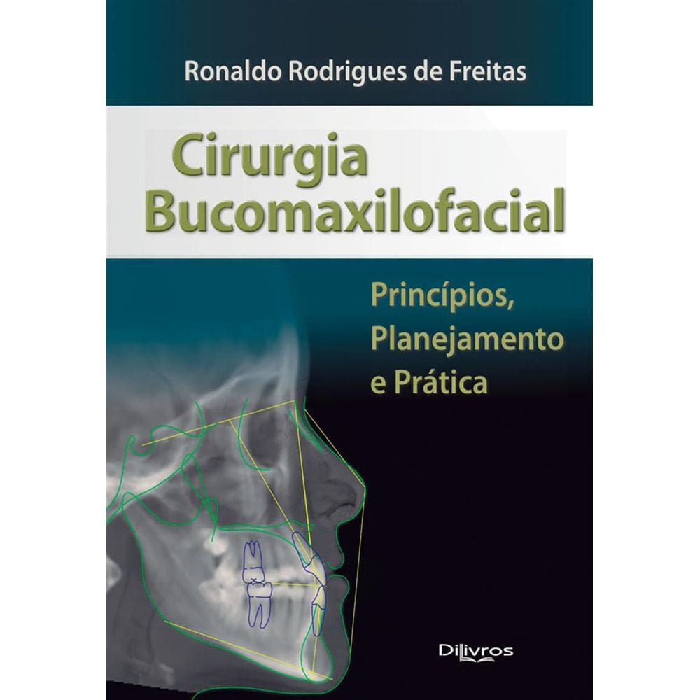 Livro Cirurgia Bucomaxilofacial