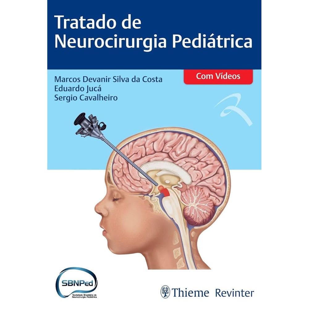 Tratado de Neurocirurgia Pediátrica