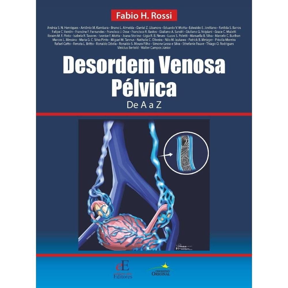 Desordem Venosa Pélvica de A a Z