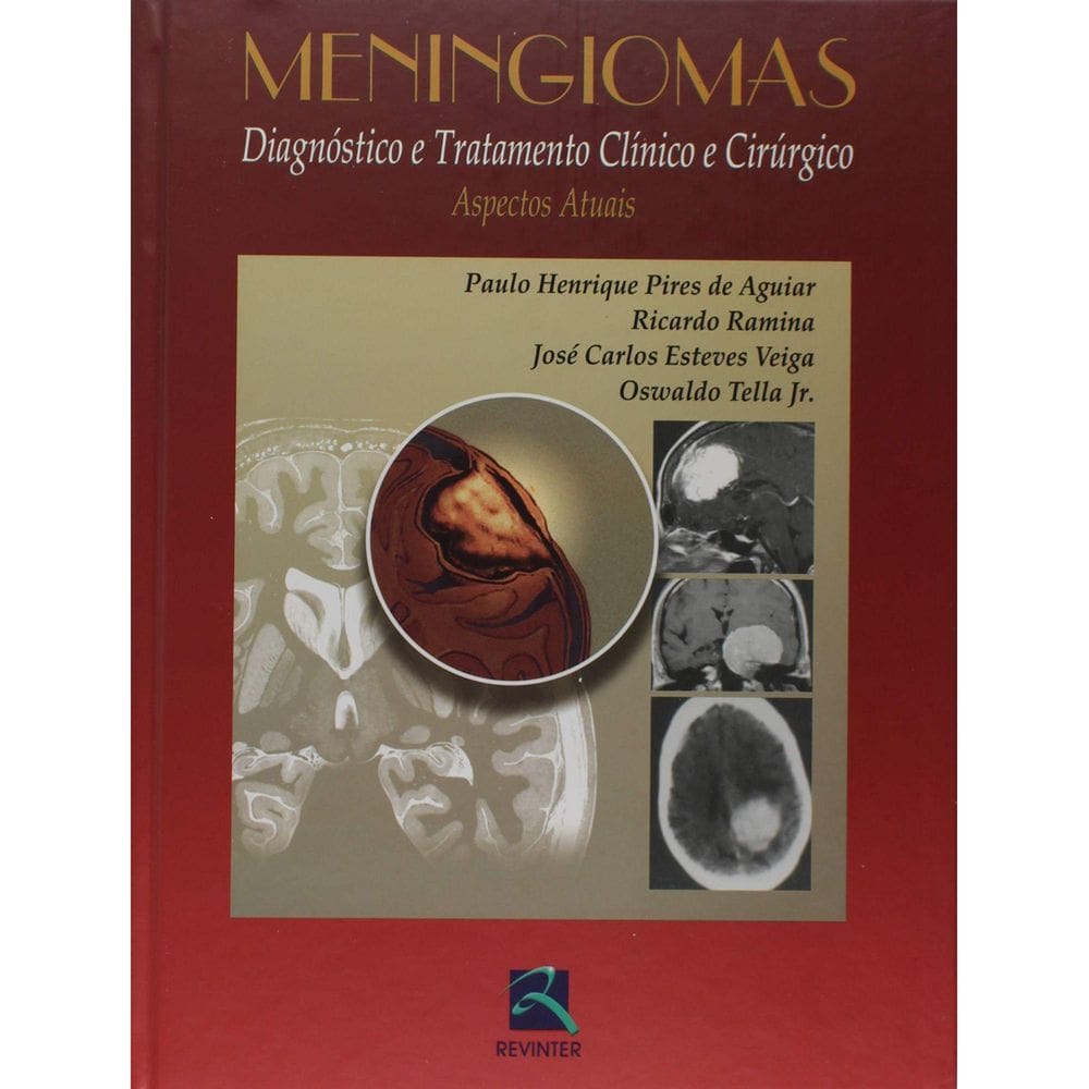 Livro Meningiomas