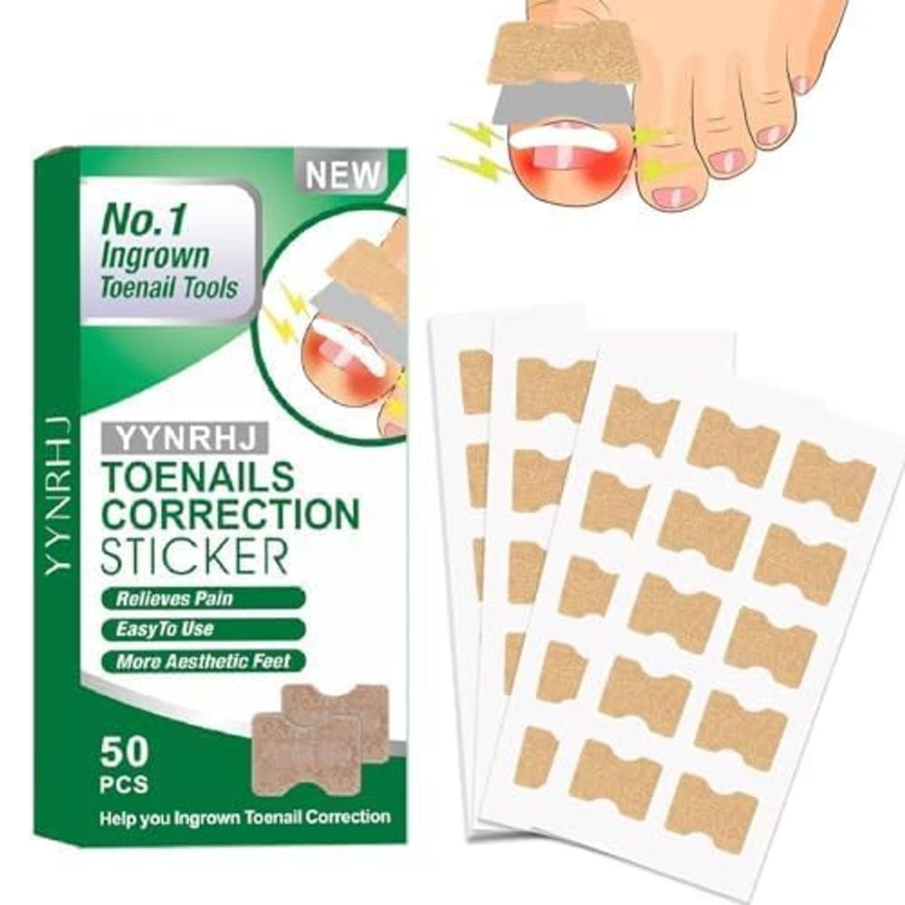 Adesivos de correção de unhas para tratamento de unhas encravadas x50