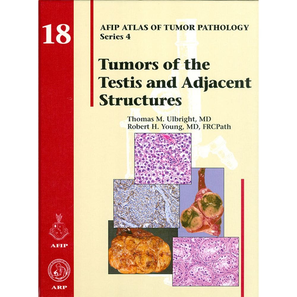 Tumors Of The Testis And Adjacent Structures