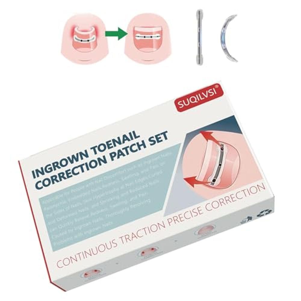 Corretor de unhas encravadas SUQILVSI Titanium Alloy 0,59/0,67/0,79 polegadas