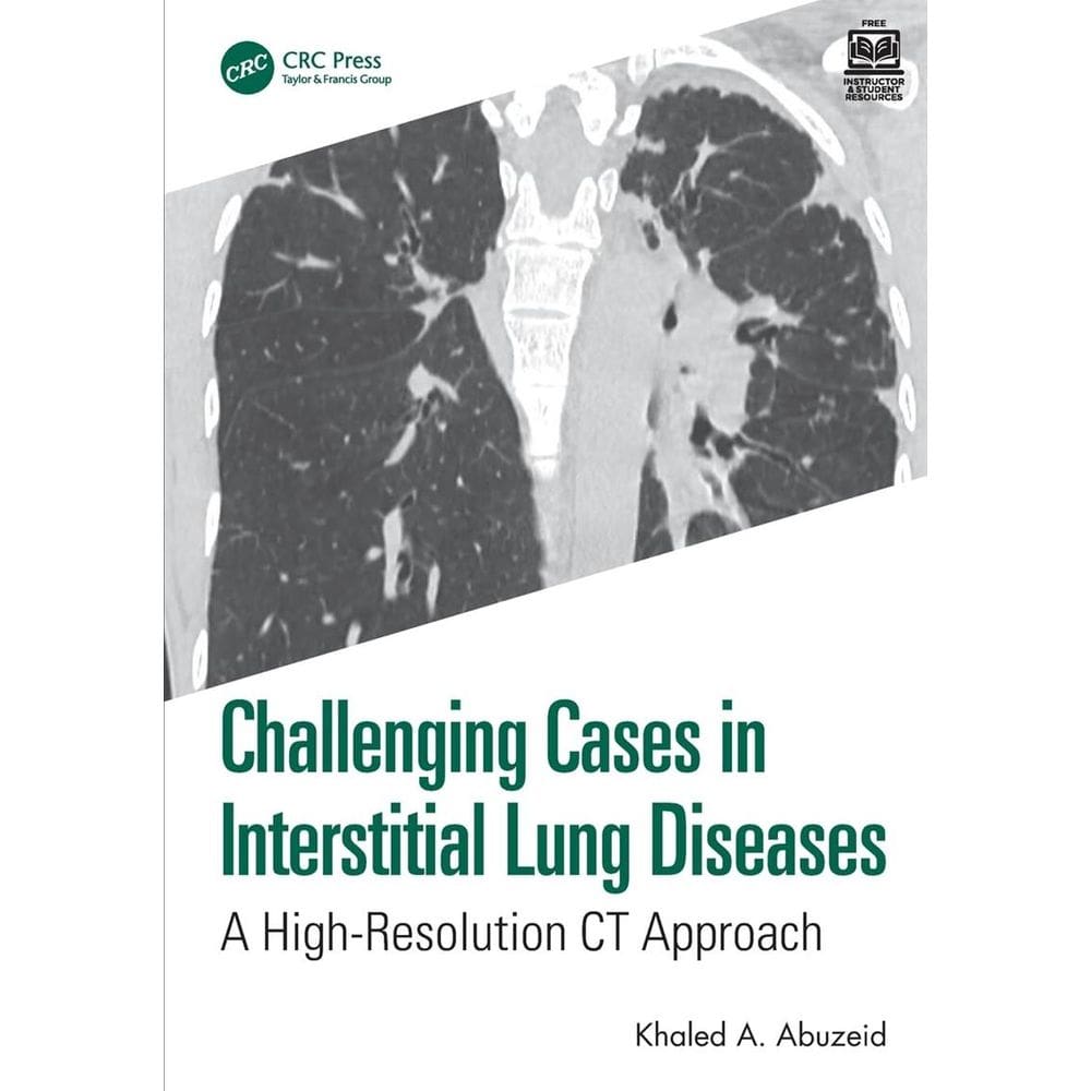 Challenging Cases in Interstitial Lung Diseases