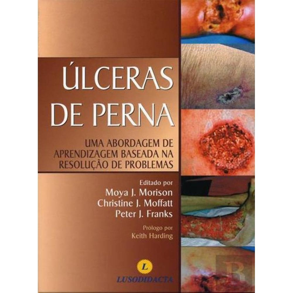 Livro Prevenção E Tratamento De Úlceras De Pressão