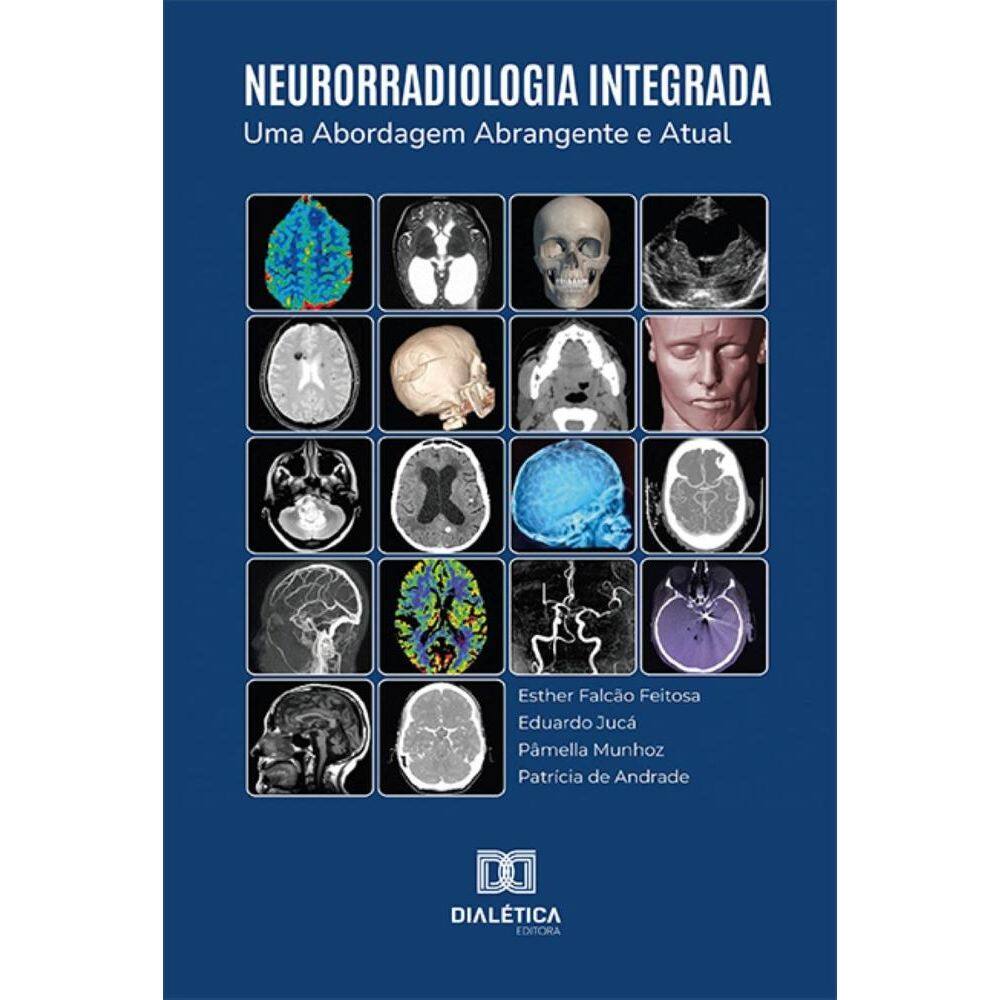 Neurorradiologia Integrada