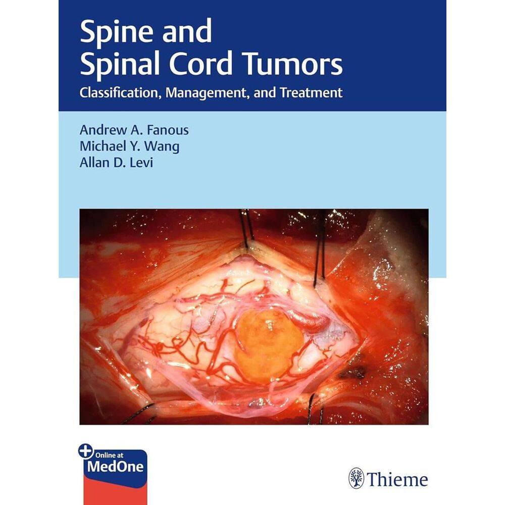 Spine And Spinal Cord Tumors