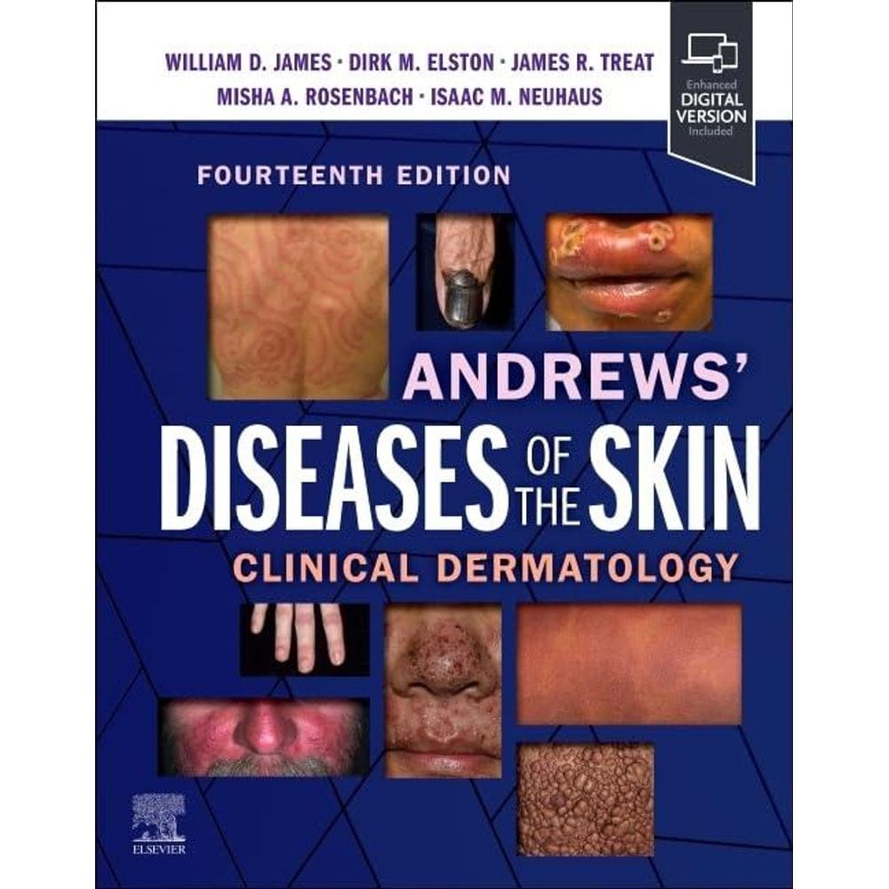 Andrews Diseases Of The Skin