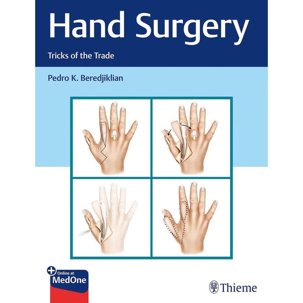 Hand Surgery Tricks Of The Trade
