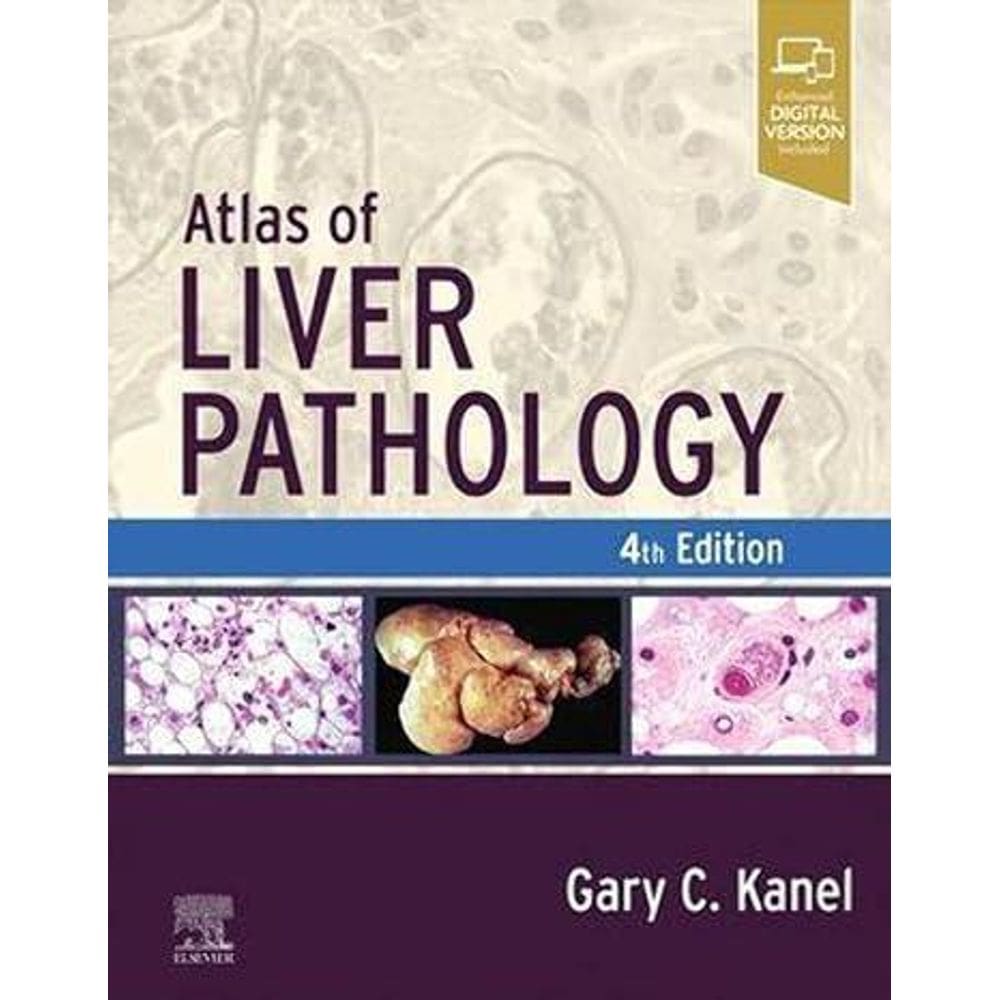 Atlas Of Liver Pathology