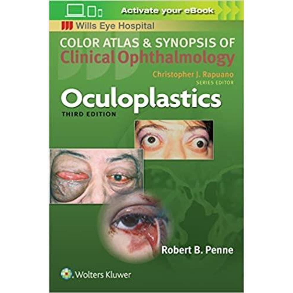 Oculoplastics