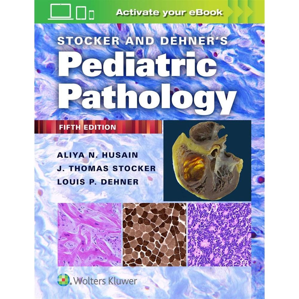 Stocker And Dehner S Pediatric Pathology