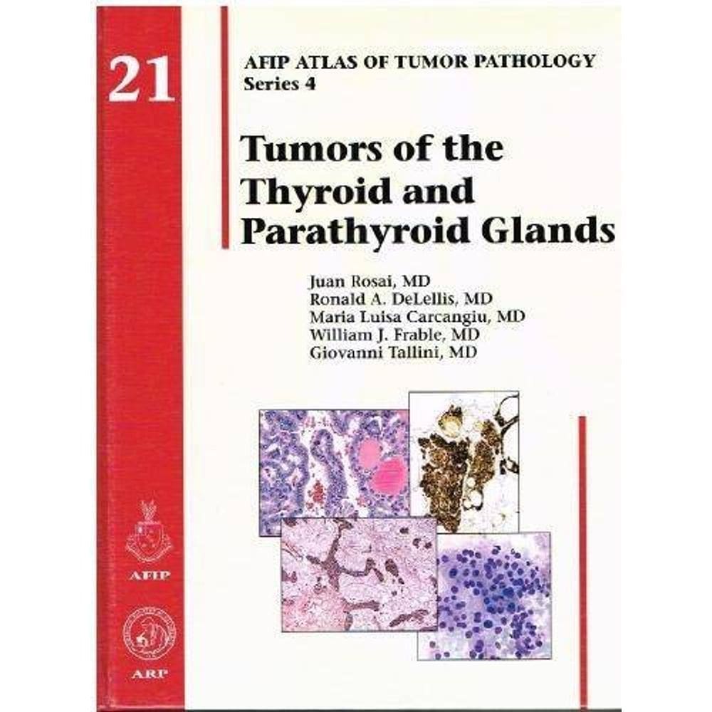 Tumors Of The Thyroid And Parathyroid Glands