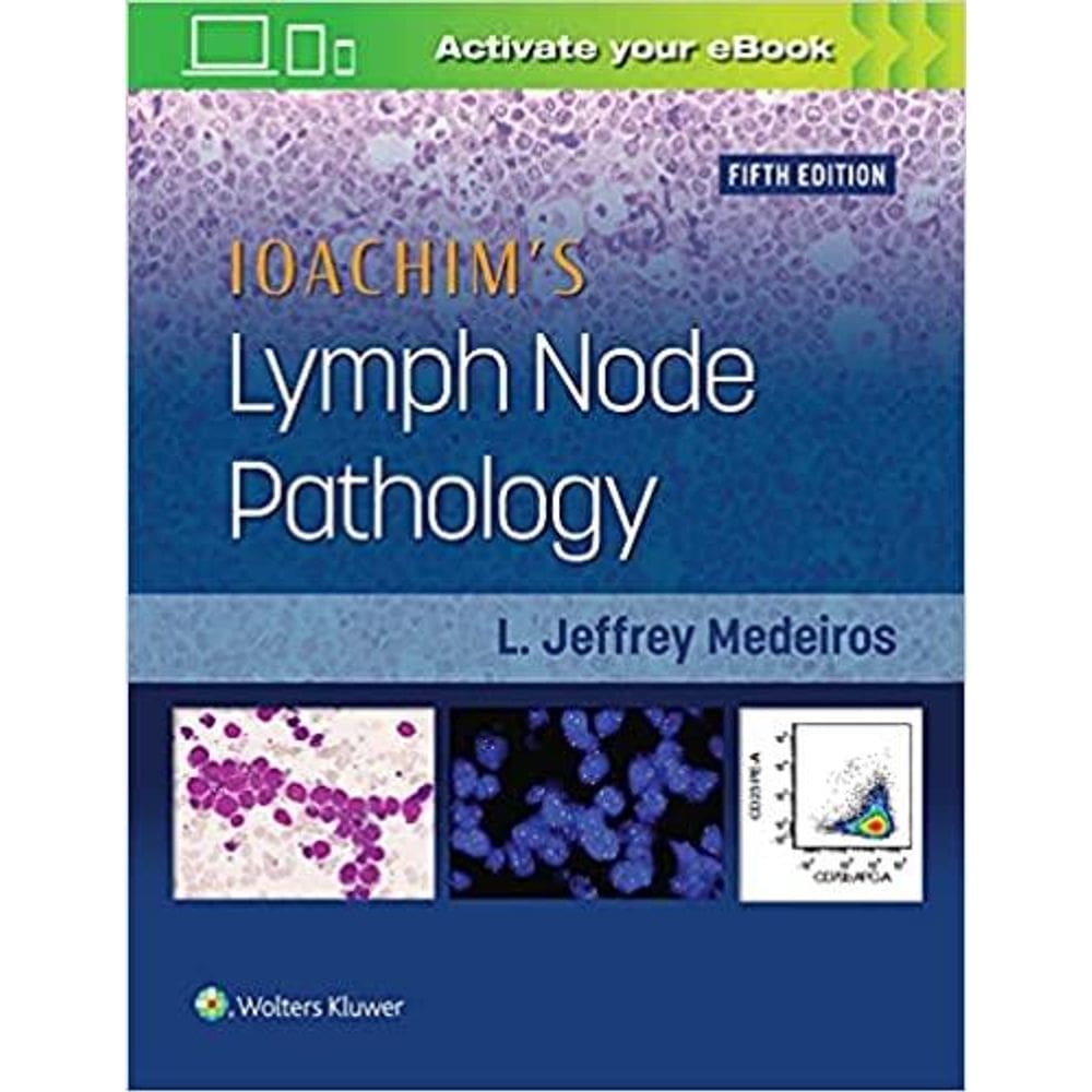 Ioachims Lymph Node Pathology