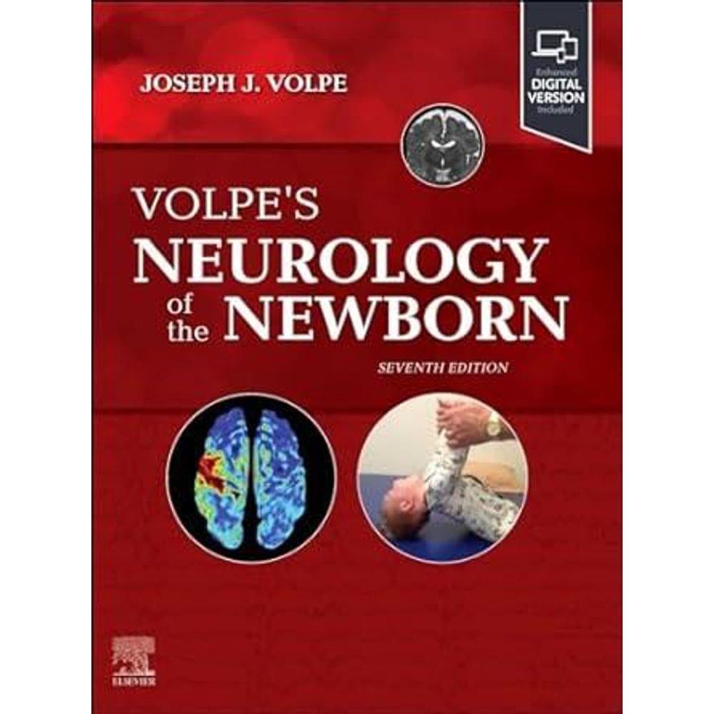 Neurology Of The Newborn